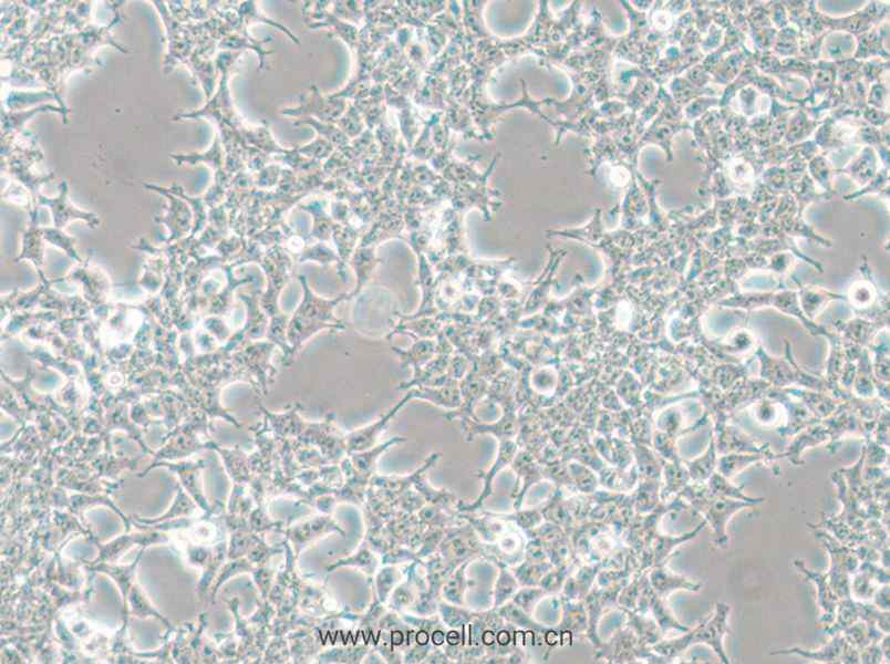 HKb20 (人肾上皮细胞) (STR鉴定正确)