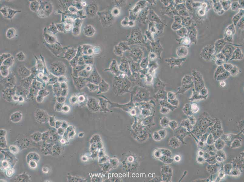 DMS 114 (人肺癌细胞) (STR鉴定正确)