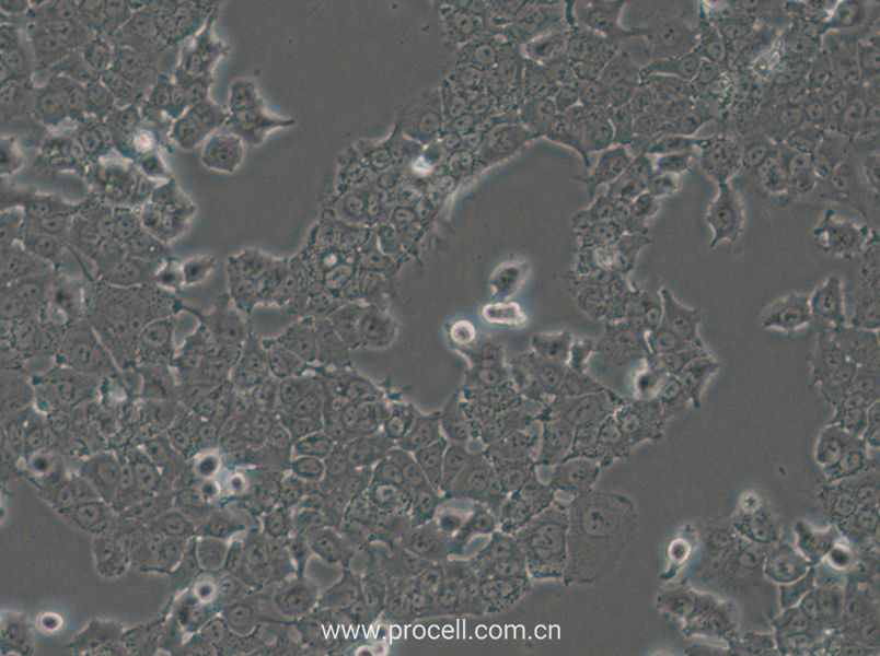 NCI-H1573 (人肺癌腺癌细胞) (STR鉴定正确)