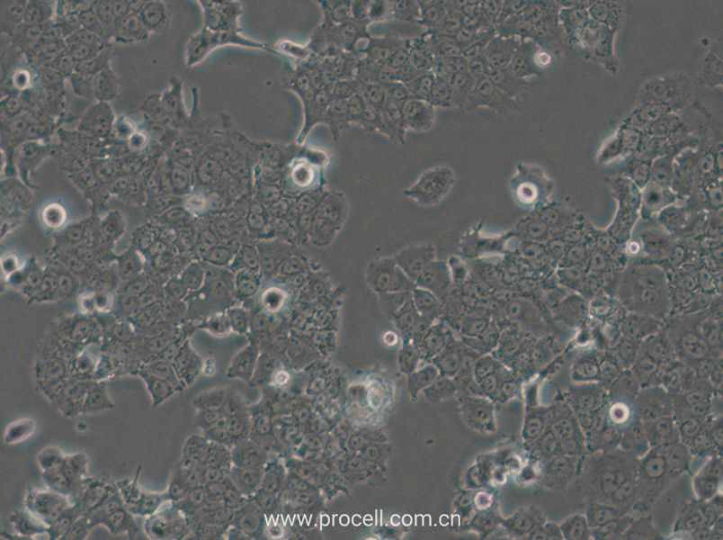 NCI-H1573 (人肺癌腺癌细胞) (STR鉴定正确)