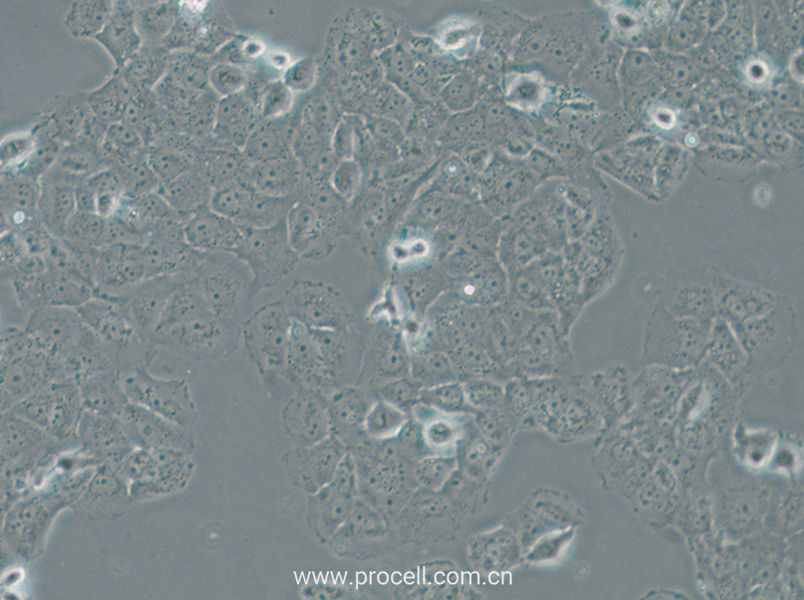OVCAR-8 (人卵巢癌细胞) (STR鉴定正确)