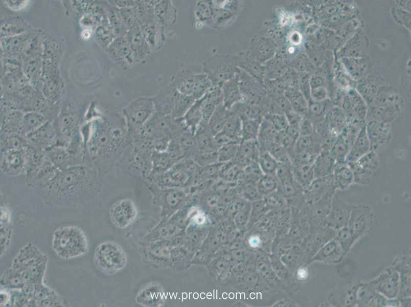 OVCAR-8 (人卵巢癌细胞) (STR鉴定正确)