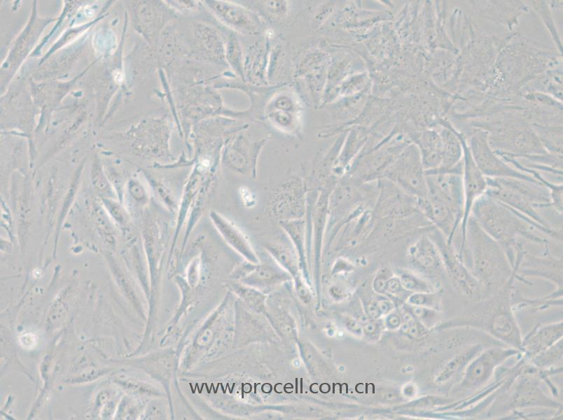 NCI-H1648 (人肺癌腺癌细胞) (STR鉴定正确)