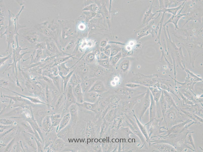 NCI-H1648 (人肺癌腺癌细胞) (STR鉴定正确)