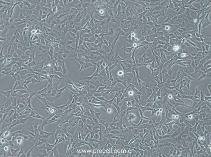 HTR-8-Svneo (人绒毛膜滋养层细胞) (STR鉴定正确)