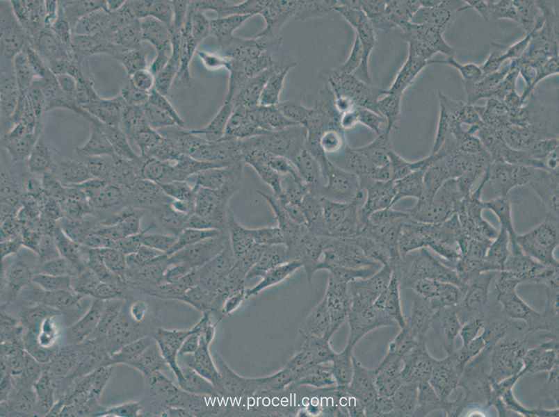HTR-8-Svneo (人绒毛膜滋养层细胞) (STR鉴定正确)