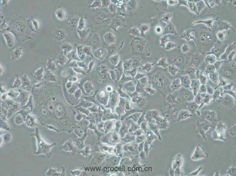 NCI-H727 (人肺癌细胞) (STR鉴定正确)