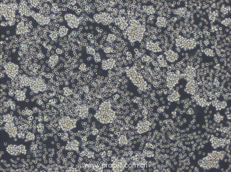 WSU-DLCL2 (人弥漫大B淋巴瘤细胞) (STR鉴定正确)