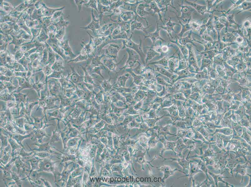 92-1 [Human uveal melanoma] (人葡萄膜黑色素瘤细胞) (STR鉴定正确)