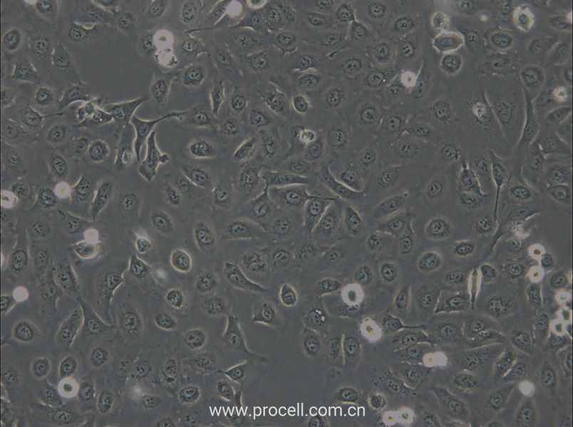 OVCA429 (人卵巢癌细胞) (STR鉴定正确)