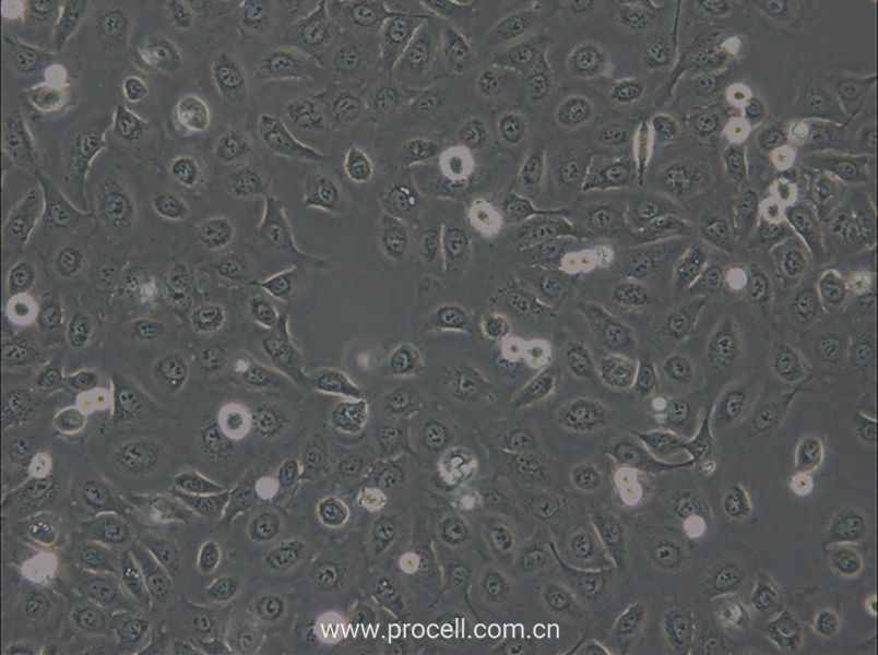 OVCA429 (人卵巢癌细胞) (STR鉴定正确)