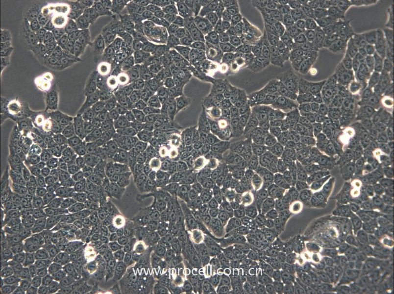 WSU-HN30 (人口腔鳞状细胞) (STR鉴定正确)