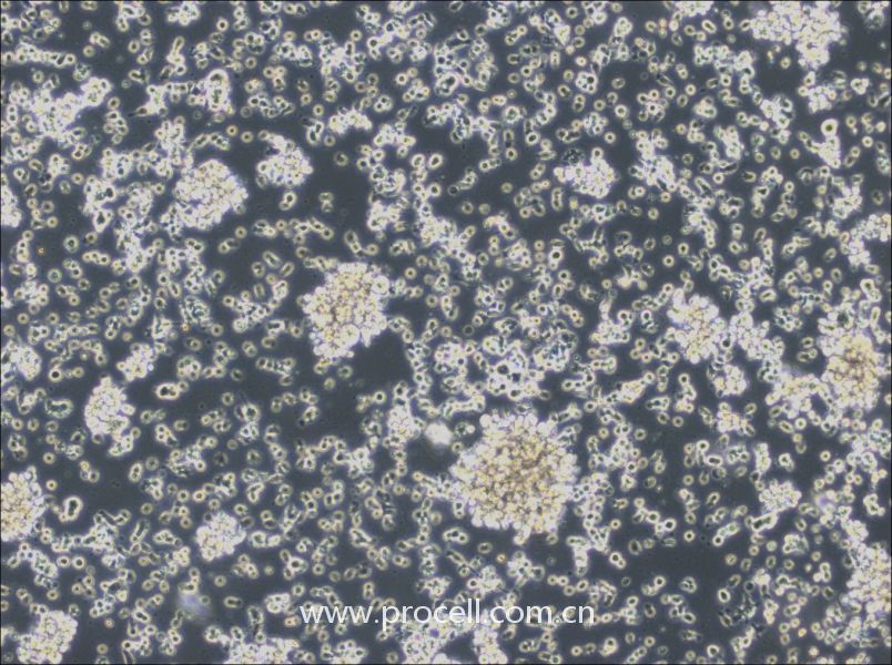 HCC38 BL (人淋巴母细胞（EBV 转化）) (STR鉴定正确)