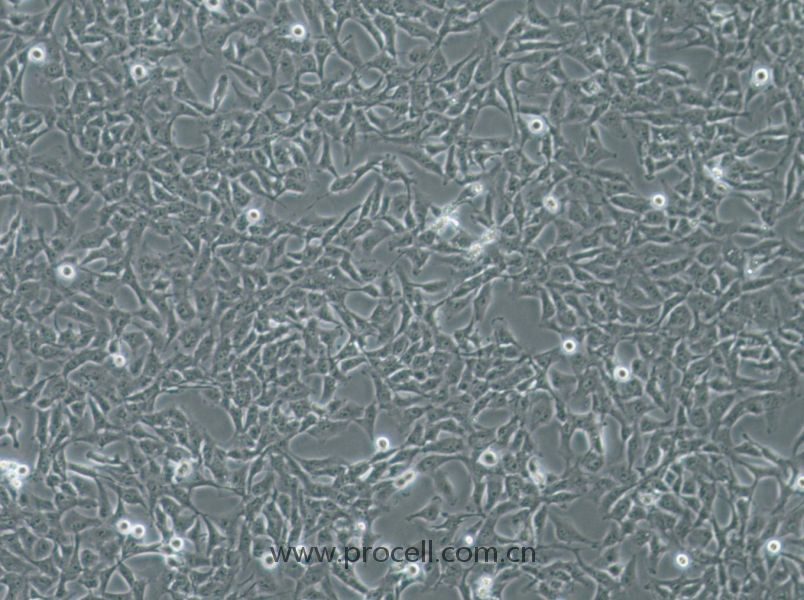 Nthy-ori 3-1 (人甲状腺正常细胞) (STR鉴定正确)