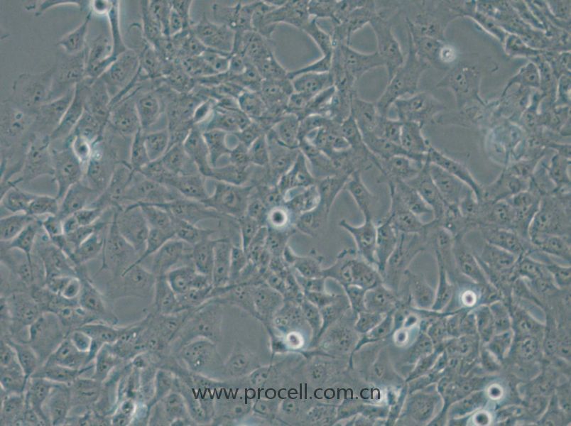 Nthy-ori 3-1 (人甲状腺正常细胞) (STR鉴定正确)