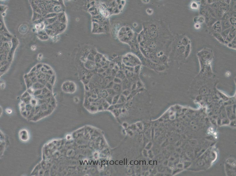 EFM-19 (人乳腺管癌细胞) (STR鉴定正确)