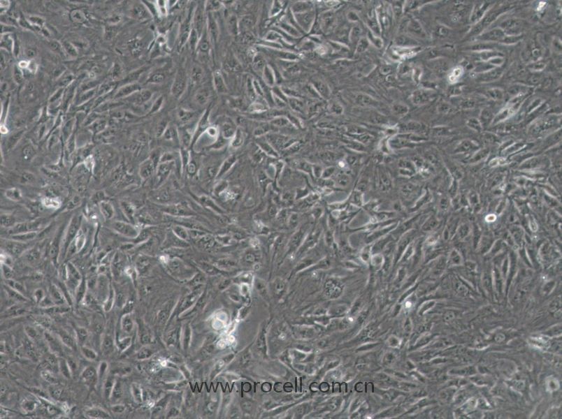 SW1710 (人膀胱癌细胞) (DMEM) (STR鉴定正确)