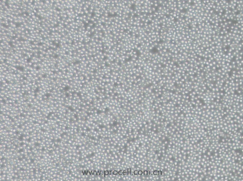OCI-AML3 (人急性髓细胞性白血病细胞) (STR鉴定正确)