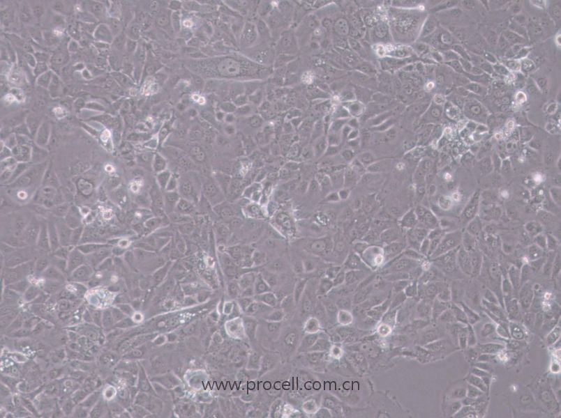 SK-N-DZ (人神经母细胞瘤细胞) (STR鉴定正确)