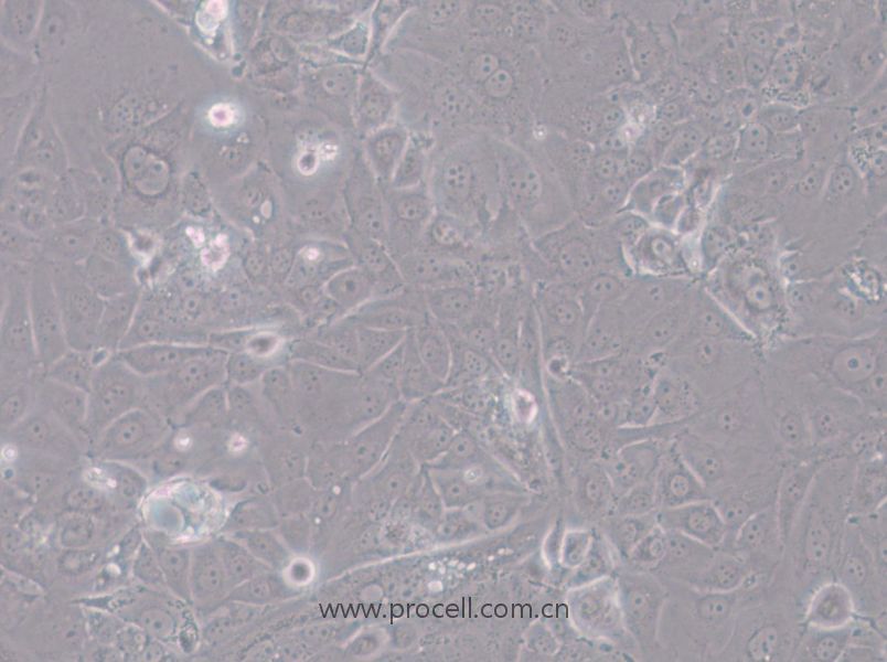 SK-N-DZ (人神经母细胞瘤细胞) (STR鉴定正确)