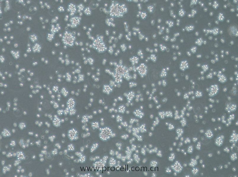 RS4;11 (人急性B淋巴细胞白血病细胞) (STR鉴定正确)