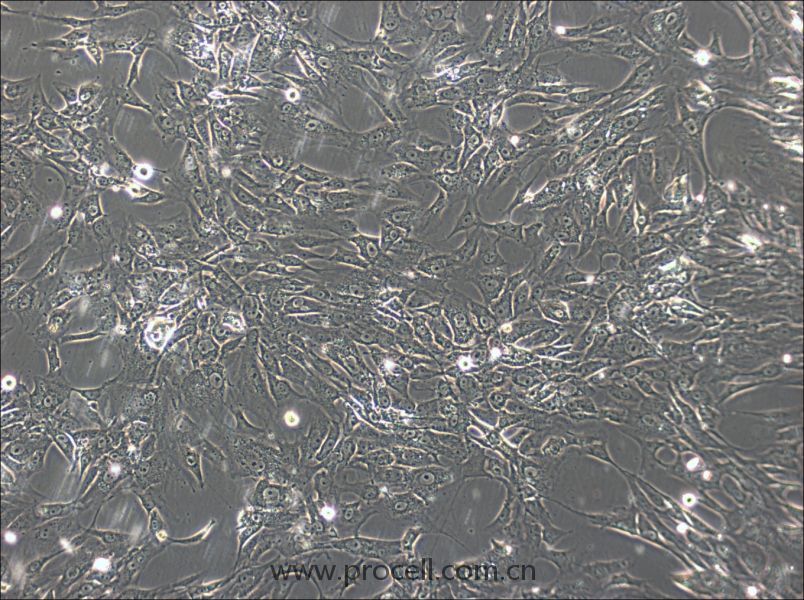 sNF96.2 (人雪旺细胞 (神经纤维瘤病Ⅰ型)) (STR鉴定正确)