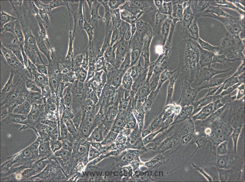 sNF96.2 (人雪旺细胞 (神经纤维瘤病Ⅰ型)) (STR鉴定正确)