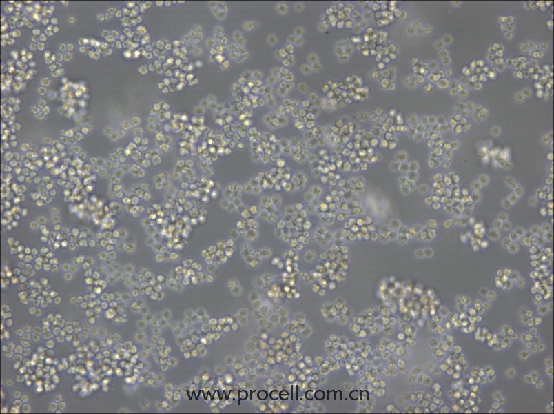 A20 (小鼠B细胞淋巴瘤) (STR鉴定正确)