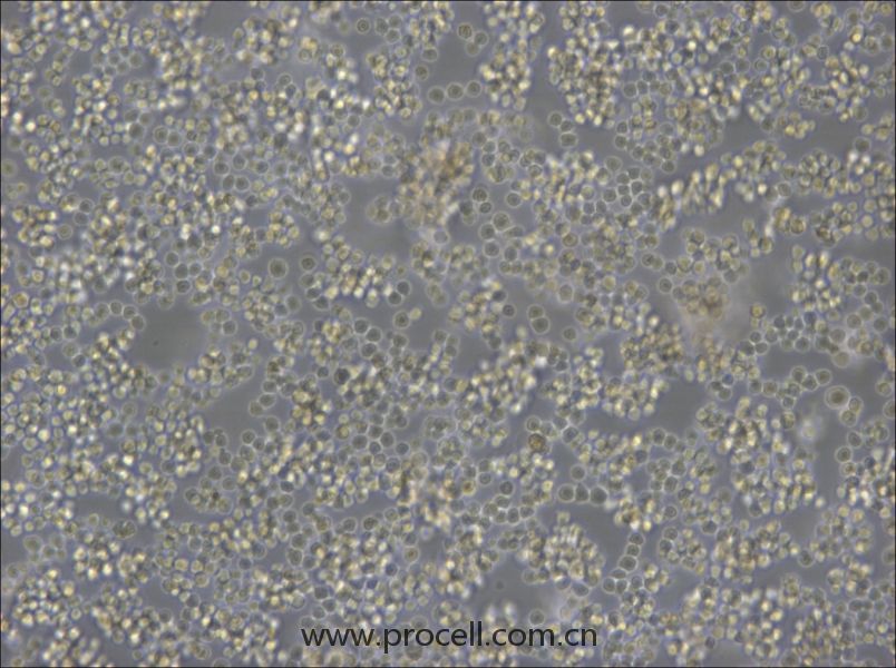 A20 (小鼠B细胞淋巴瘤) (STR鉴定正确)