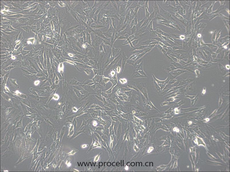 SW1783  (人脑星形胶质细胞瘤细胞) (STR鉴定正确)
