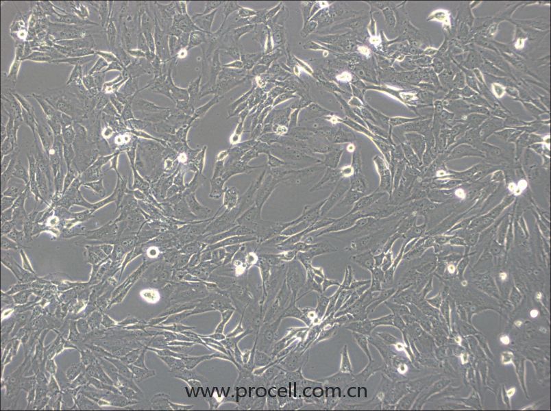 SW1783  (人脑星形胶质细胞瘤细胞) (STR鉴定正确)