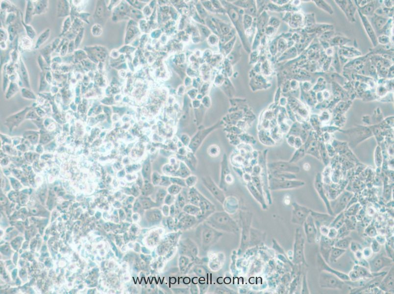MES-SA (人子宫肉瘤细胞) (STR鉴定正确)