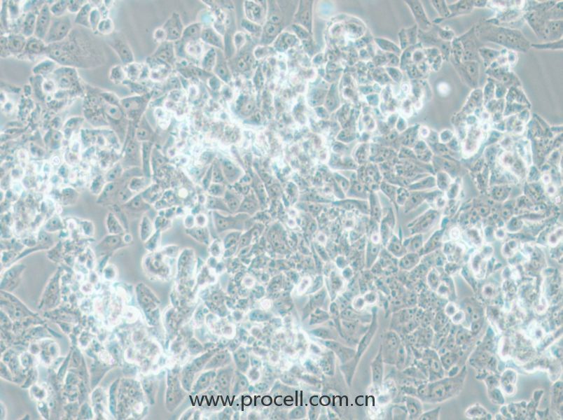 MES-SA (人子宫肉瘤细胞) (STR鉴定正确)