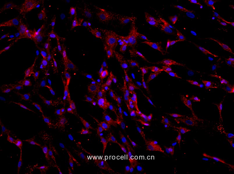 人骨髓间充质干细胞
