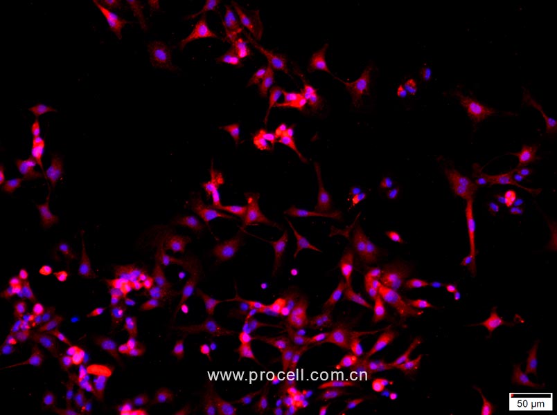 小鼠Ⅱ型肺泡上皮细胞