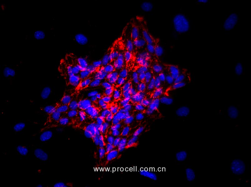 小鼠心脏微血管内皮细胞
