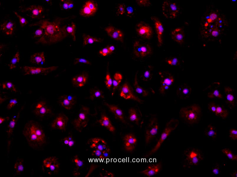 小鼠骨髓来源内皮祖细胞