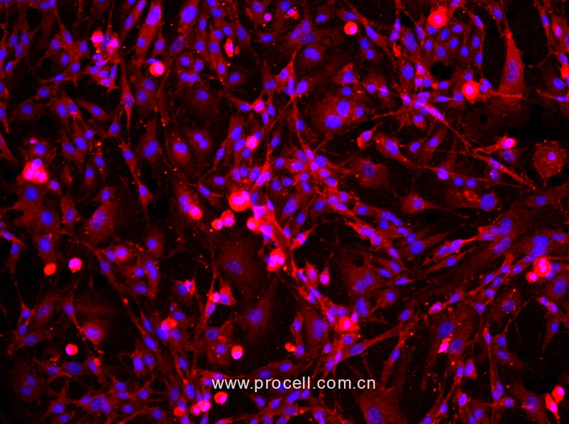 小鼠海绵体内皮细胞