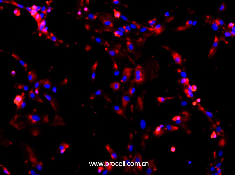 大鼠Ⅱ型肺泡上皮细胞