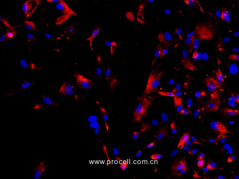 大鼠Ⅱ型肺泡上皮细胞