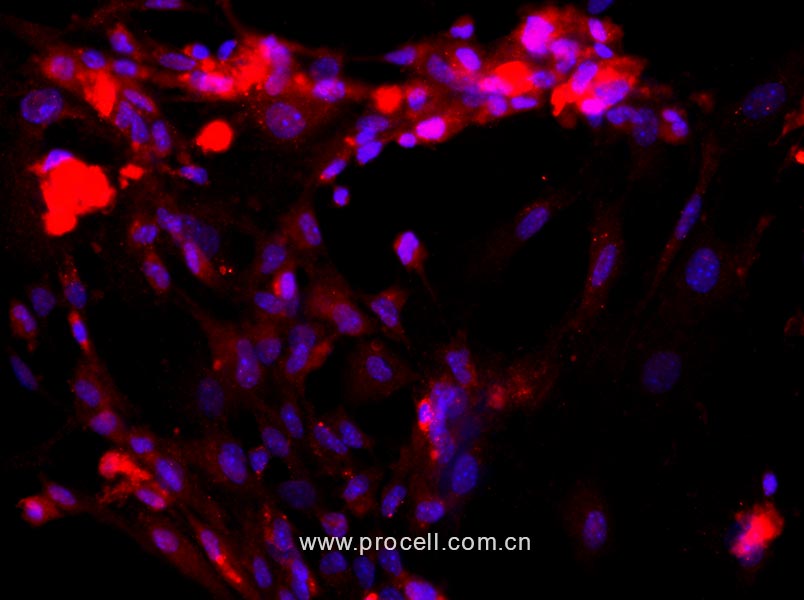 大鼠肝窦内皮细胞