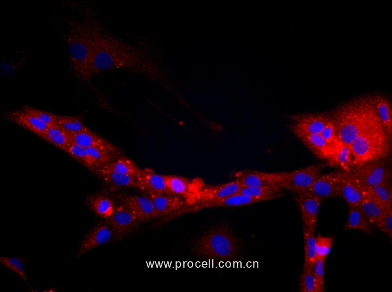 大鼠肾小球内皮细胞