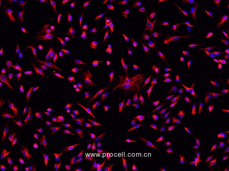 大鼠心肌成纤维细胞