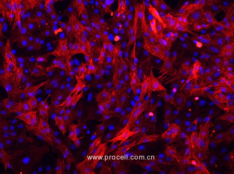 大鼠主动脉平滑肌细胞