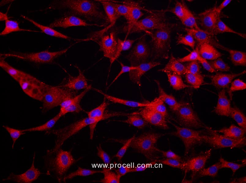 大鼠骨髓来源内皮祖细胞